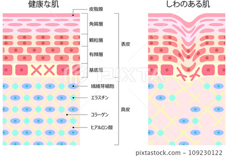 Cross section of healthy skin and wrinkled skin Cross section of healthy skin and wrinkled skin 109230122