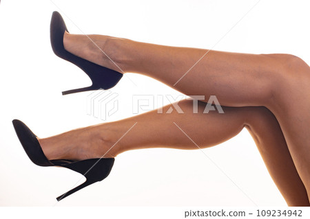 Painful varicose and spider veins on female legs. 109234942