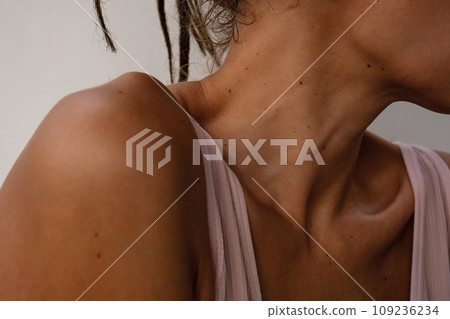 Female shoulder and neck. Sunburn body. Female shoulder and neck. Sunburn body. 109236234