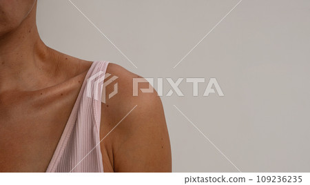 Female shoulder and neck. Sunburn body. Female shoulder and neck. Sunburn body. 109236235