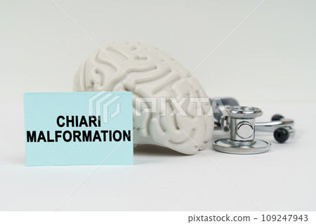On a white surface next to the brain there is a stethoscope and stickers with the inscription - Chiari malformation On a white surface next to the brain there is a stethoscope and stickers with the inscription - Chiari malformation 109247943