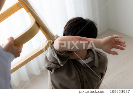 DV形象男受害者版（疤痕為特殊妝容） 109253927