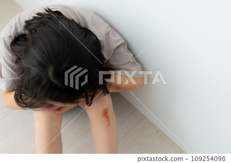 兒童受傷圖片（受傷為特殊化妝） 109254098