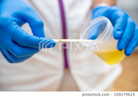 Close up of Nurse Hand holding urine sample container for medical urine analysis with color strip. 109279628