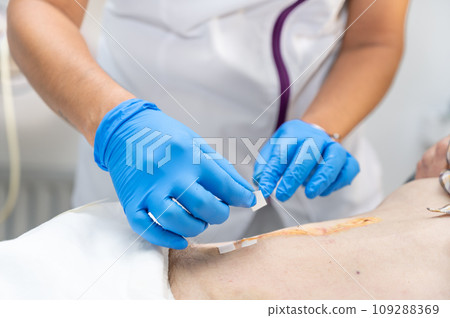 hand of Doctor is using clean cotton dressing infection wound at a man abdomen. Bandage for wound 109288369