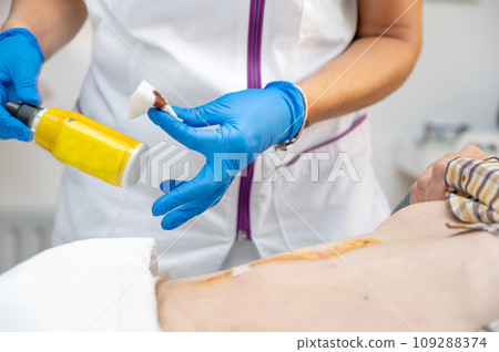 hand of Doctor is using clean cotton dressing infection wound at a man abdomen. Bandage for wound hand of Doctor is using clean cotton dressing infection wound at a man abdomen. Bandage for wound 109288374