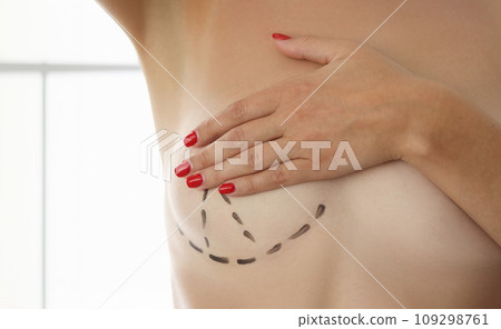 Breast correction and plastic surgery and small female breasts 109298761