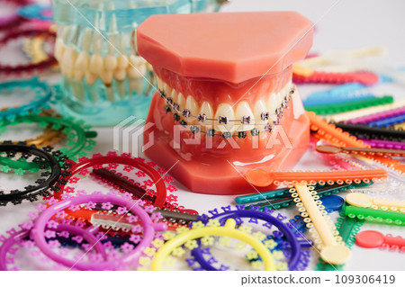Orthodontic ligatures rings and ties, elastic rubber bands on orthodontic braces, model for dentist studying about dentistry. Orthodontic ligatures rings and ties, elastic rubber bands on orthodontic braces, model for dentist studying about dentistry. 109306419