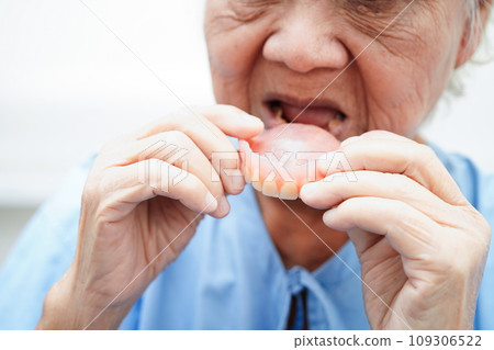 Asian senior woman patient wearing teeth denture into her mouth for chew food. Asian senior woman patient wearing teeth denture into her mouth for chew food. 109306522