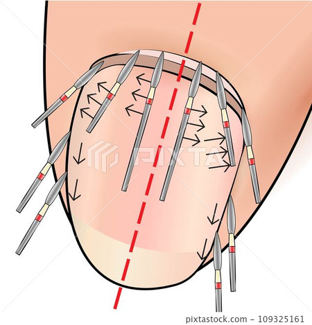 Illustration with hardware manicure technology. Correct position of the cutter in the vector. Educational material Illustration with hardware manicure technology. Correct position of the cutter in the vector. Educational material 109325161