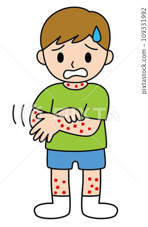 昆蟲叮咬和手腳踝濕疹的症狀 109331992