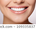 A Close-Up of a Woman's Smile with White Teeth 109335837