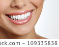 A Close-Up of a Woman's Smile with White Teeth 109335838