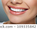 A Close-Up of a Woman's Smile with White Teeth 109335842