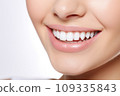 A Close-Up of a Woman's Smile with White Teeth 109335843