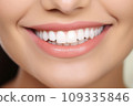 A Close-Up of a Woman's Smile with White Teeth 109335846