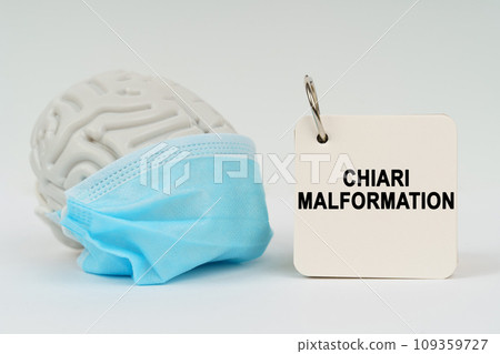 On a white surface there is a brain with a blue mask and a notepad with the inscription - Chiari malformation On a white surface there is a brain with a blue mask and a notepad with the inscription - Chiari malformation 109359727