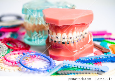 Orthodontic ligatures rings and ties, elastic rubber bands on orthodontic braces, model for dentist studying about dentistry. Orthodontic ligatures rings and ties, elastic rubber bands on orthodontic braces, model for dentist studying about dentistry. 109360912