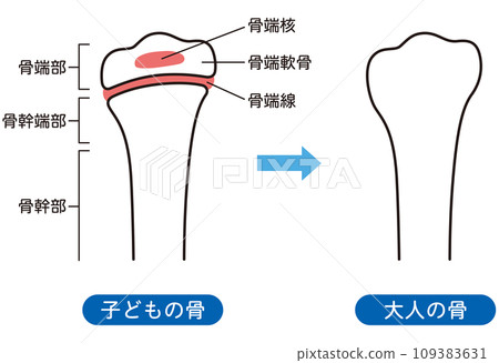 骨骺線 兒童骨骼與成人骨骼 骨骼生長 109383631