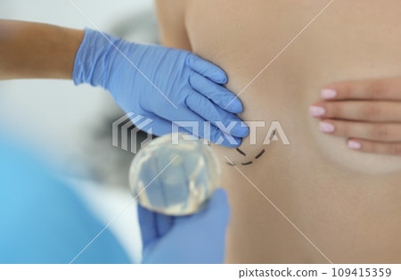 Hand in rubber medical glove holds woman's mammary gland with drawn line around closeup 109415359