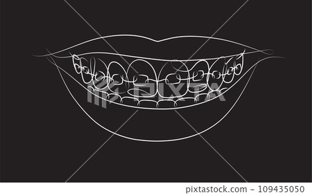 Smile with teeth braces black color 109435050