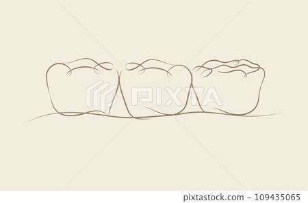 Implanted teeth with crown bridge beige color Implanted teeth with crown bridge beige color 109435065