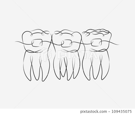 Teeth with braces white color 109435075