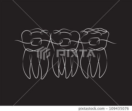 Teeth with braces black color 109435076