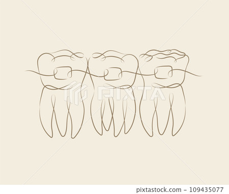 Teeth with braces beige color 109435077
