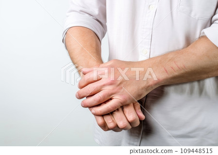 Skin diseases-allergies, psoriasis,diseases symptoms concept, Generative AI 109448515