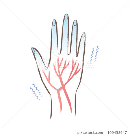 對冷終端敏感 手部和指尖冰冷、血流不良的圖示 109458647