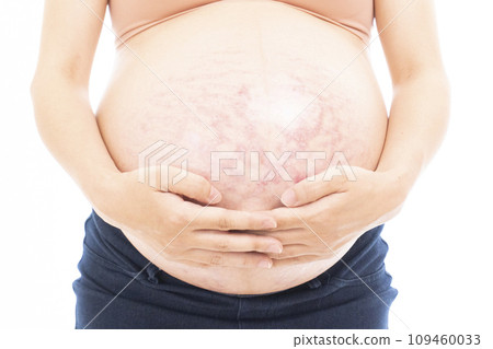 Pregnant woman putting her hand on her stomach with stretch marks and midline 109460033