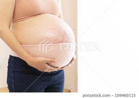 足月孕婦的胃和腹帶 109460115