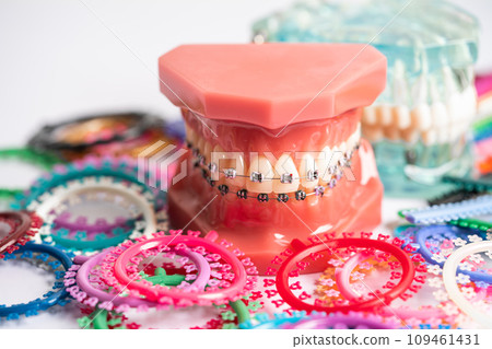 Orthodontic ligatures rings and ties, elastic rubber bands on orthodontic braces, model for dentist studying about dentistry. 109461431