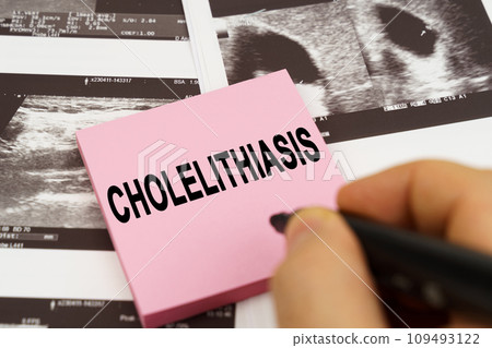 On the ultrasound pictures there are stickers that say - Cholelithiasis 109493122
