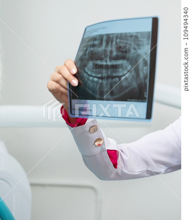 Xray photo of human teeth 109494340