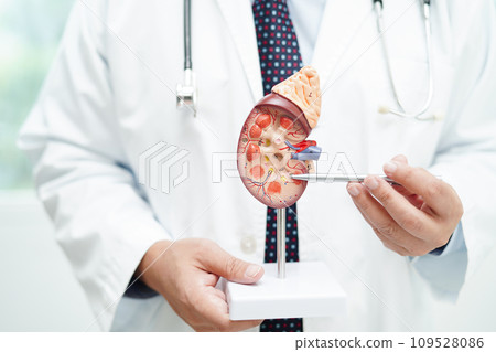 Chronic kidney disease, doctor with model for treatment urinary system, urology, Estimated glomerular filtration rate eGFR. Chronic kidney disease, doctor with model for treatment urinary system, urology, Estimated glomerular filtration rate eGFR. 109528086