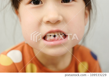 The child who lost his baby teeth for the first time 109533229