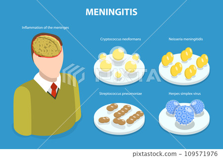 3D Isometric Flat Vector Illustration of Meningitis 109571976