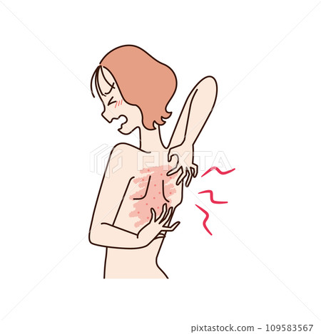 後背發癢的女人 109583567