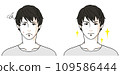 一個男人在患痤瘡之前和之後的插圖 1 109586444