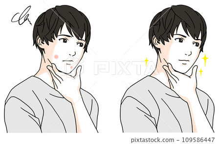 一個男人在患痤瘡之前和之後的插圖 2 109586447