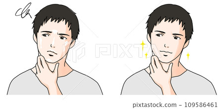 Before and after illustration of a man suffering from oiliness 3 109586461