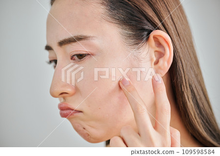 Women in their 30s who are concerned about skin wrinkles and acne Women in their 30s who are concerned about skin wrinkles and acne 109598584