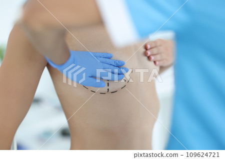 Closeup of body of naked sexy woman with black surgical marks on chest 109624721