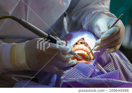 doctor cleaning the teeth patient with ultrasonic tool 109648986