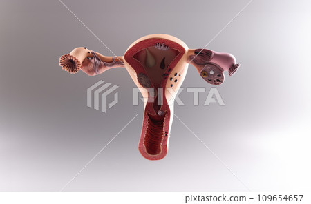 Anatomical model of uterus and ovaries, woman reproductive organs Anatomical model of uterus and ovaries, woman reproductive organs 109654657