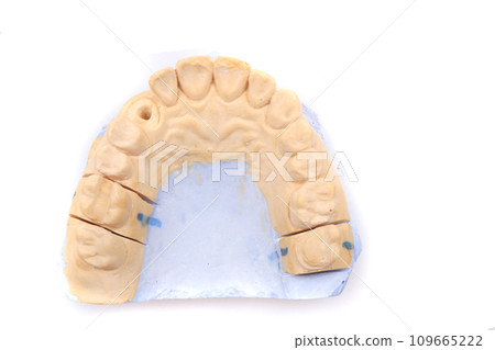 model of tooth prothesis model of tooth prothesis 109665222