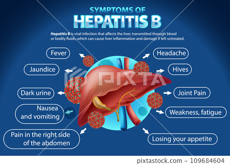 Symptoms of Hepatitis B Infographic 109684604