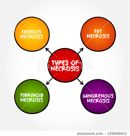 Types of Necrosis (death of body tissue) mind map text concept for presentations and reports Types of Necrosis (death of body tissue) mind map text concept for presentations and reports 109689052